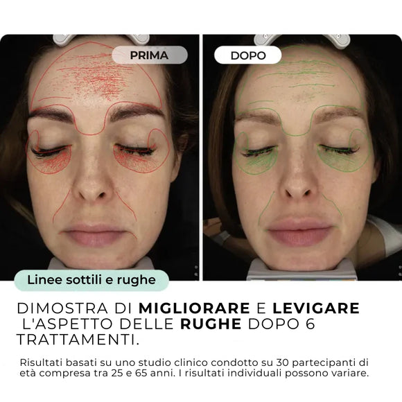 Feature product image